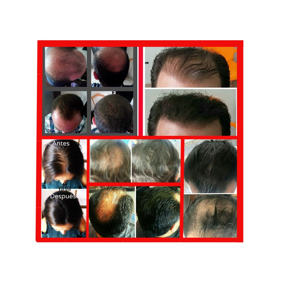 B) 1 piece of Volosy hair thickening fibers 27.5 gr / 0.97 oz., lasts 1.5 - 2 months. (FREE SHIPPING TO ALL U.S.A)